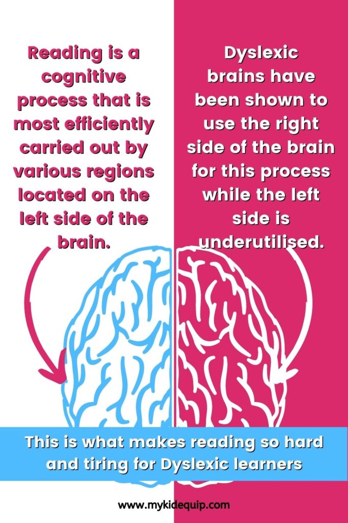 An image to show how dyslexic brains have been shown to use the right side of the brain for reading instead of more efficient left side.